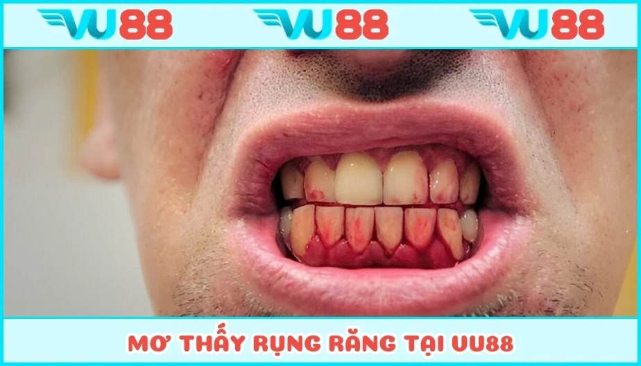 VU88 Mơ Thấy Rụng Răng - Ý Nghĩa Chiêm Bao Và Con Số Tương Ứng